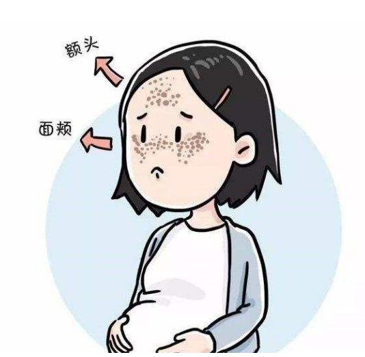 湿疹五个特点