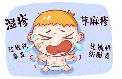 大庆湿疹治疗
